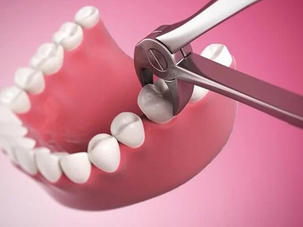 Trông thấy nhổ răng ớn lạnh với điềm báo gì
